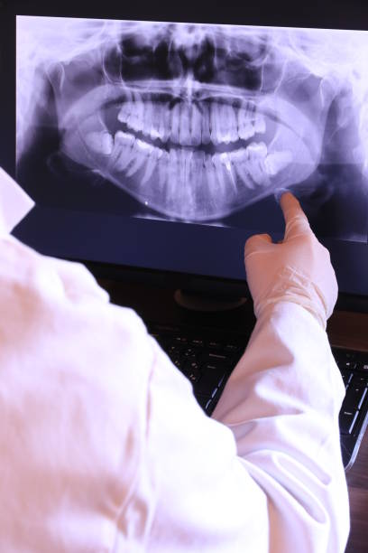 Best Emergency Treatment for Toothache in Georgetown, OH
